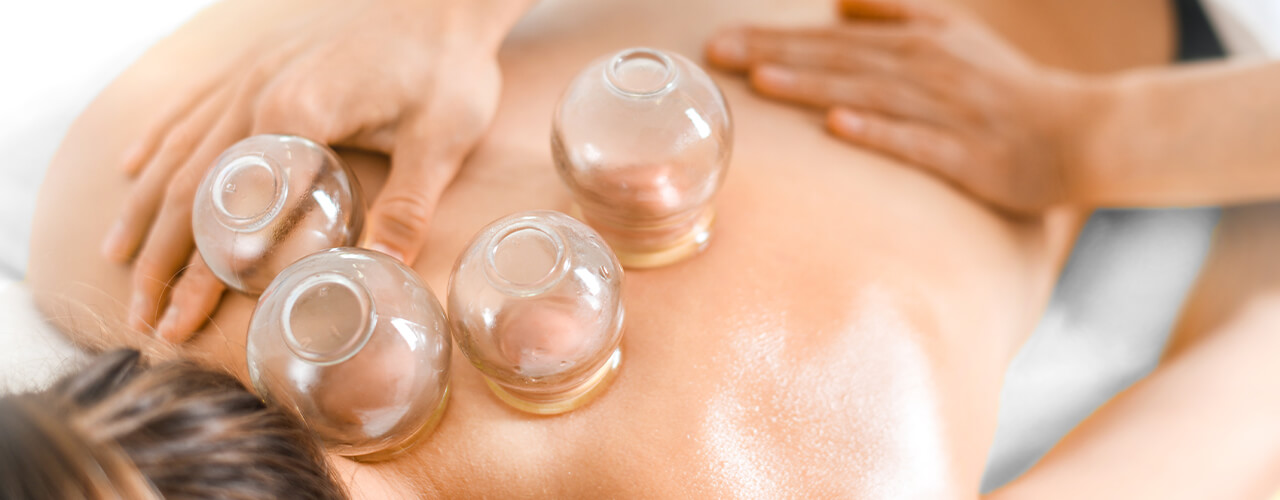 Cupping Matthews, Waxhaw, Charlotte & Monroe, NC