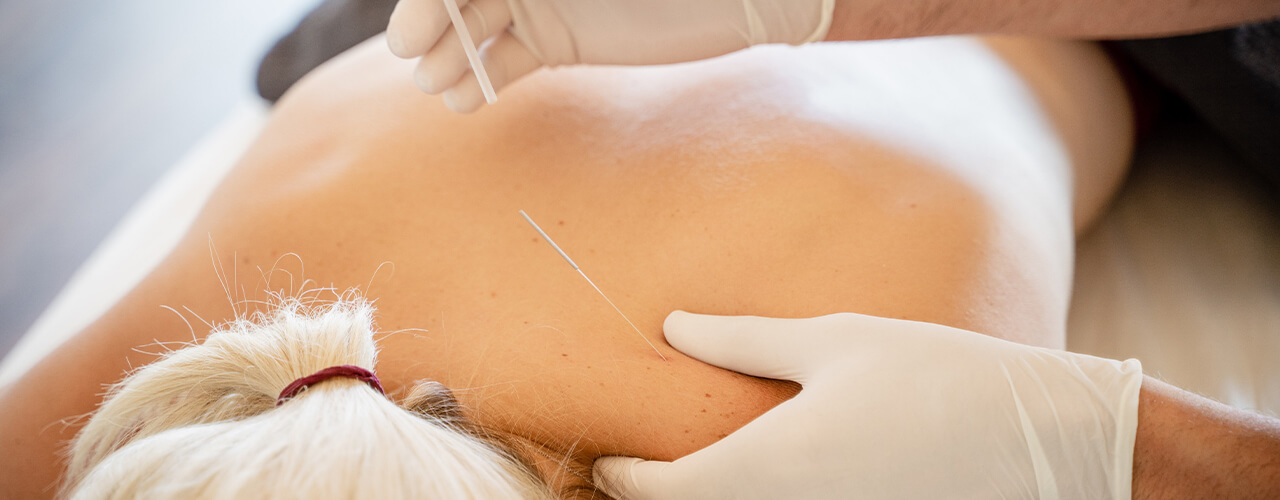 Dry Needling Matthews, Waxhaw, Charlotte & Monroe, NC